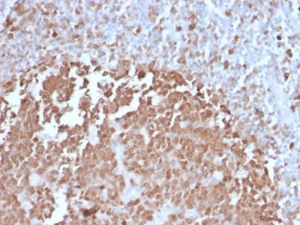 Formalin-fixed, paraffin-embedded human Tonsil stained with BOB1 Mouse Monoclonal Antibody (BOB1/2422).