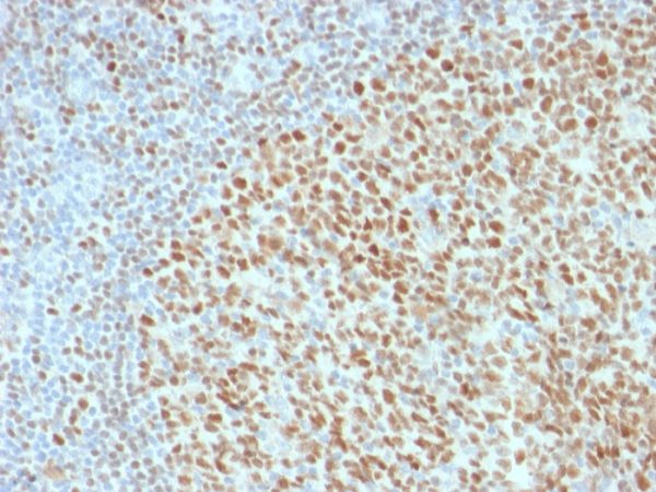 Formalin-fixed, paraffin-embedded human Tonsil stained with Oct-2 Mouse Monoclonal Antibody (OCT2/2136).