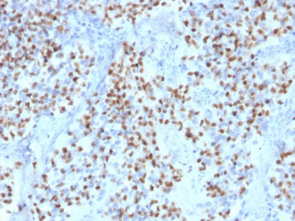 Formalin-fixed, paraffin-embedded human Lymph Node stained with Oct-2 Mouse Monoclonal Antibody (OCT2/2136).