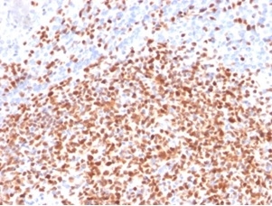 Formalin-fixed, paraffin-embedded human lymph node stained with Oct-2 Mouse Monoclonal Antibody (OCT2/2137). HIER: Tris/EDTA, pH9.0, 45min. 2 °: HRP-polymer, 30min. DAB, 5min.