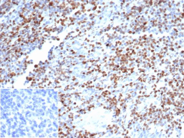 Formalin-fixed, paraffin-embedded human tonsil stained with Oct-2 Recombinant Rabbit Monoclonal Antibody (OCT2/7073R). HIER: Tris/EDTA, pH9.0, 45min. 2 °: HRP-polymer, 30min. DAB, 5min.