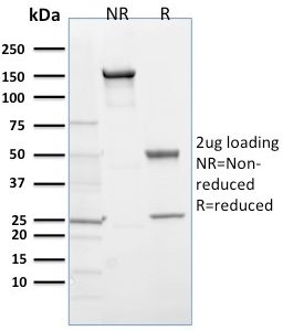SDS-PAGE Analysis of Purified EGLN1 / PHD2 Mouse Monoclonal Antibody (366G/76/3). Confirmation of Purity and Integrity of Antibody.