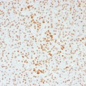 Formalin-fixed, paraffin-embedded human Pancreas stained with ATRX Mouse Monoclonal Antibody (39f).