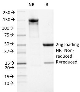 SDS-PAGE Analysis Purified ATRX Mouse Monoclonal Antibody (23c). Confirmation of Integrity and Purity of Antibody.