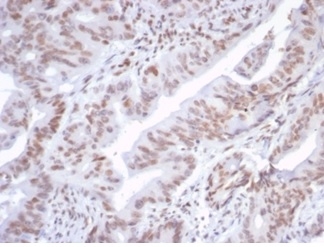 Formalin-fixed, paraffin-embedded human colon stained with ATRX Recombinant Rabbit Monoclonal Antibody (ATRX/7188R).