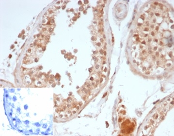 Formalin-fixed, paraffin-embedded human testis stained with OCT4 Recombinant Rabbit Monoclonal Antibody (OCT4/6875R). Inset: PBS instead of primary antibody, secondary negative control.