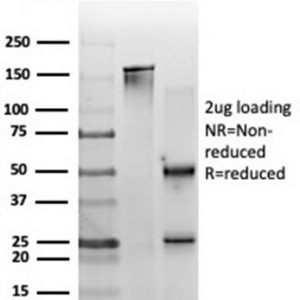 SDS-PAGE Analysis. Purified ZNF562 Mouse Monoclonal Antibody (PCRP-ZNF562-1A1).  Confirmation of Purity and Integrity of Antibody.