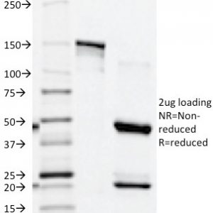 SDS-PAGE Analysis of Purified PSAP Mouse Monoclonal Antibody (ACPP/1339). Confirmation of Integrity and Purity of Antibody.