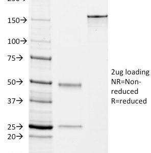 SDS-PAGE Analysis of Purified DOG-1 Mouse Monoclonal Antibody (DG1/447).