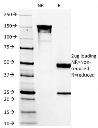SDS-PAGE Analysis of Purified DOG-1 Mouse Monoclonal Antibody (DG1/1485). Confirmation of Integrity and Purity of Antibody DOG-1 / TMEM16A (Gastrointestinal Stromal Tumor Marker) Antibody - Image 2