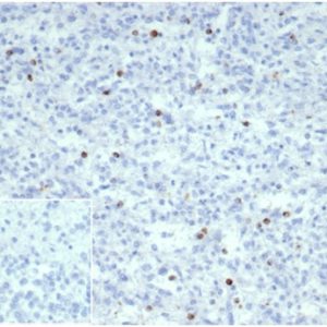 Formalin-fixed, paraffin-embedded human spleen stained with Perforin-1Recombinant Rabbit Monoclonal Antibody(PRF1/7077R). Inset: PBS instead of primary antibody; secondary only negative control.