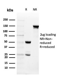 SDS-PAGE Analysis of Purified Intelectin 1 / Omentin Mouse Monoclonal Antibody (ITLN1/4065). Confirmation of Purity and Integrity of Antibody.