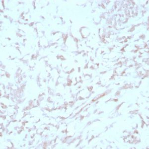 Formalin-fixed, paraffin-embedded human liver stained with KIND1 Mouse Monoclonal Antibody (4A5.14).