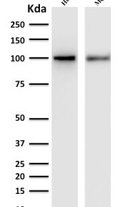 Western Blot Analysis of human HeLa and MCF-7 cell lysate with ENAH / MENA Mouse Monoclonal Antibody (ENAH/1988).