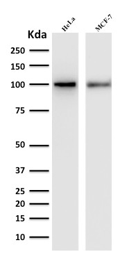 Western Blot Analysis of human HeLa and MCF-7 cell lysate with ENAH / MENA Mouse Monoclonal Antibody (ENAH/1988).