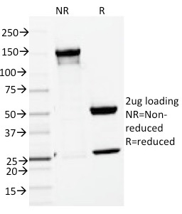 SDS-PAGE Analysis of Purified ENAH / MENA Mouse Monoclonal Antibody (ENAH/1988). Confirmation of Purity and Integrity of Antibody.