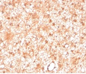 Formalin-fixed, paraffin-embedded human brain stained with Protein Kinase C iota / lambda Mouse Monoclonal Antibody (PRKCI/4911).
