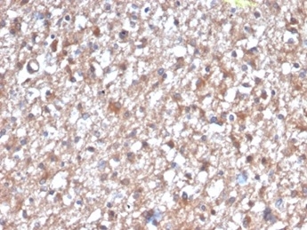 Formalin-fixed, paraffin-embedded human brain stained with Protein Kinase C iota / lambda Mouse Monoclonal Antibody (PRKCI/4912).