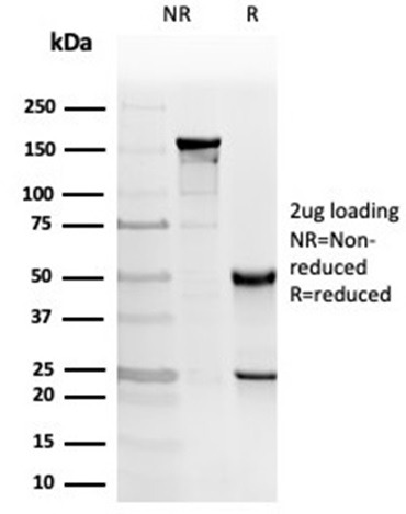 SDS-PAGE Analysis of Purified PRKCI Mouse Monoclonal Antibody (PRKCI/4912). Confirmation of Purity and Integrity of Antibody.