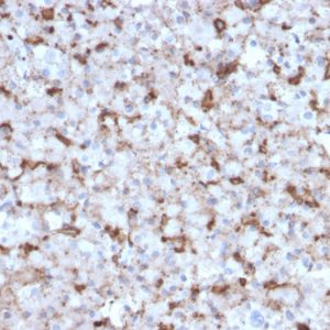 Formalin-fixed, paraffin-embedded human Pituitary stained with Prolactin Mouse Monoclonal Antibody (PRL/2643).