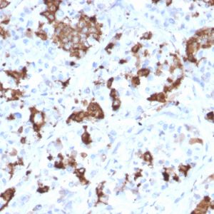 Formalin-fixed, paraffin-embedded human Pituitary stained with Prolactin Mouse Monoclonal Antibody (PRL/2644).