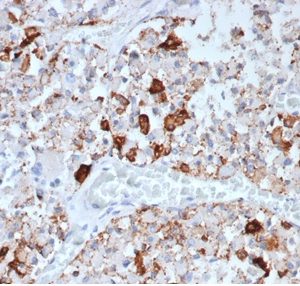 Formalin-fixed, paraffin-embedded human pituitary stained with Prolactin Recombinant Mouse Monoclonal Antibody (rPRL/4907).