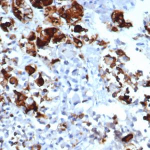 Formalin-fixed, paraffin-embedded human pituitary stained with Prolactin Recombinant Mouse Monoclonal Antibody (rPRL/4909).