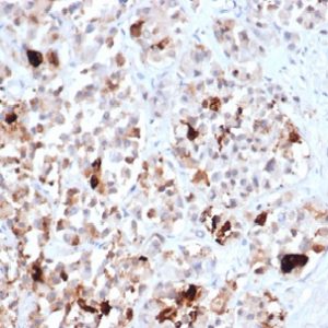 Formalin-fixed, paraffin-embedded human pituitary stained with Prolactin Recombinant Rabbit Monoclonal Antibody (PRL/4906R).