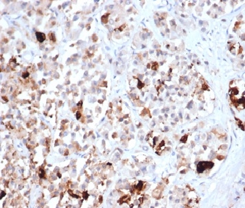 Formalin-fixed, paraffin-embedded human pituitary stained with Prolactin Recombinant Rabbit Monoclonal Antibody (PRL/4906R).