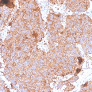 Formalin-fixed, paraffin-embedded human pituitary stained with Prolactin Recombinant Rabbit Monoclonal Antibody (PRL/4908R).