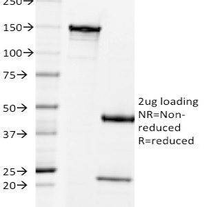 SDS-PAGE Analysis of Purified Prolactin Receptor Mouse Monoclonal Antibody (B6.2). Confirmation of Integrity and Purity of Antibody.