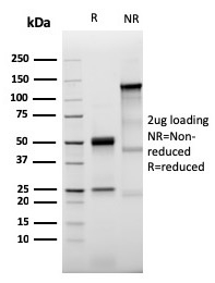 SDS-PAGE Analysis of Purified Prolactin Receptor Recombinant Rabbit Monoclonal (PRLR3785R). Confirmation of Integrity and Purity of Antibody.