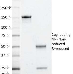 SDS-PAGE Analysis Purified Beta-2-Microglobulin Mouse Monoclonal Antibody (246-E9.E7). Confirmation of Integrity and Purity of Antibody.