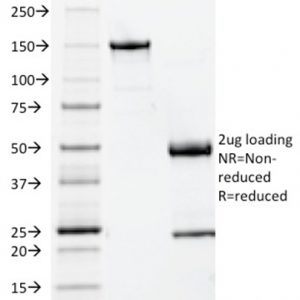 SDS-PAGE Analysis Purified Beta-2-Microglobulin Mouse Monoclonal Antibody (BBM.1). Confirmation of Integrity and Purity of Antibody.