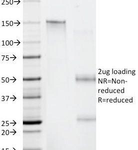 SDS-PAGE Analysis of Purified Beta-2-Microglobulin Mouse Monoclonal Antibody (C21.48A1). Confirmation of Integrity and Purity of Antibody.