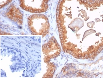 Formalin-fixed, paraffin-embedded human prostate stained with B2M Recombinant Mouse Monoclonal Antibody (rB2M/7279). Inset: PBS instead of primary antibody; secondary only negative control.