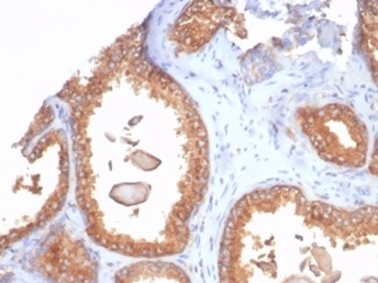 Formalin-fixed, paraffin-embedded human prostate stained with B2M Recombinant Mouse Monoclonal Antibody (rB2M/7279). HIER: Tris/EDTA, pH9.0, 45min. 2°C: HRP-polymer, 30min. DAB, 5min.