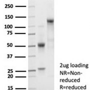 SDS-PAGE Analysis of Purified B2M Rabbit Recombinant Monoclonal Antibody (B2M/7013R). Confirmation of Purity and Integrity of Antibody.