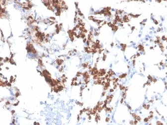 Formalin-fixed, paraffin-embedded human bone marrow stained with Resistin Mouse Monoclonal Antibody (RETN/3331).