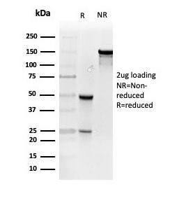 SDS-PAGE Analysis of Purified Resistin Mouse Monoclonal Antibody (RETN/4327). Confirmation of Purity and Integrity of Antibody.