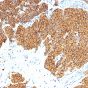 Formalin-fixed, paraffin-embedded human Parathyroid Gland stained with PTH Mouse Monoclonal Antibody (3H9).