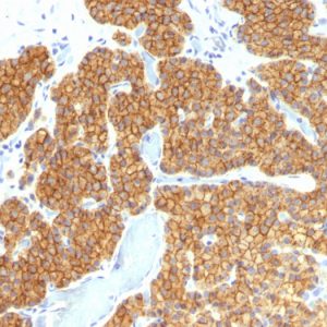 Formalin-fixed, paraffin-embedded human Parathyroid stained with PTH Mouse Monoclonal Antibody (PTH/911).