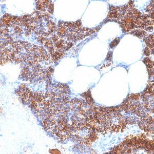 Formalin-fixed, paraffin-embedded human Parathyroid stained with PTH Mouse Monoclonal Antibody (SPM604).