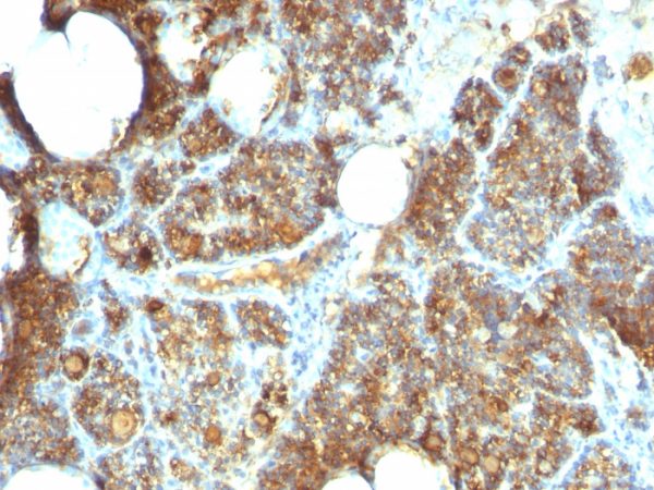 Formalin-fixed, paraffin-embedded human Parathyroid stained with PTH Mouse Monoclonal Antibody (PTH/1173).