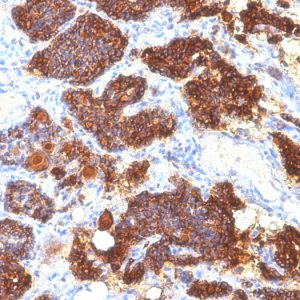 Formalin-fixed, paraffin-embedded human Parathyroid Gland stained with PTH Mouse Monoclonal Antibody (PTH/1175).