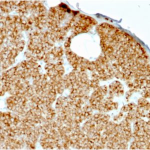 Formalin-fixed, paraffin-embedded human Parathyroid stained with PTH Mouse Recombinant Monoclonal Antibody (rPTH/911).