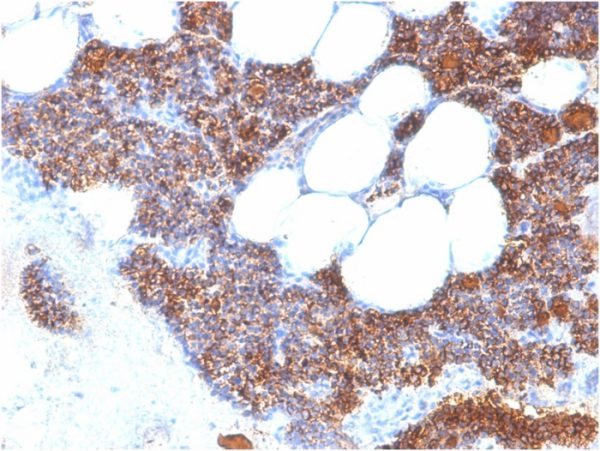 Formalin-fixed, paraffin-embedded human Parathyroid Gland stained with PTH-Monospecific Recombinant Rabbit Monoclonal Antibody (PTH/2295R).