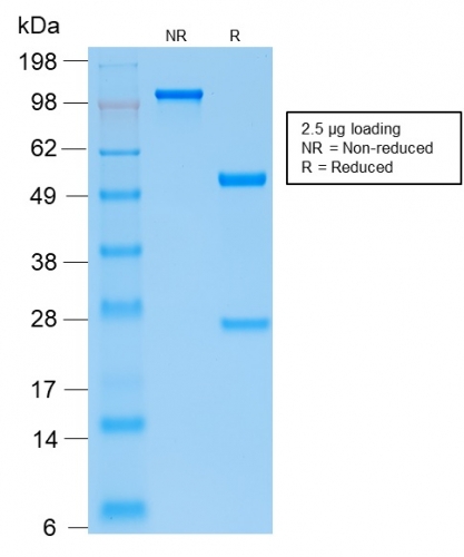 SDS-PAGE Analysis of Purified PTH Monospecific Recombinant Rabbit Monoclonal Antibody (PTH/2295R). Confirmation of Integrity and Purity of the Antibody.