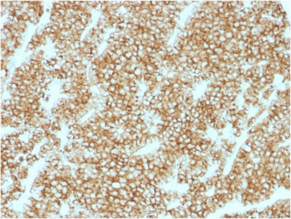 Formalin-fixed, paraffin-embedded human Parathyroid stained with PTH Rabbit Recombinant Monoclonal Antibody (PTH/1717R).