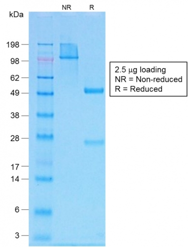 SDS-PAGE Analysis Purified PTH Rabbit Recombinant Monoclonal Antibody (PTH/1717R). Confirmation of Purity and Integrity of Antibody.